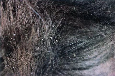 Перхоть у кошки